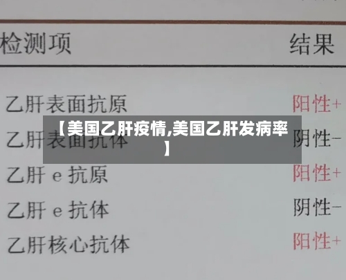 【美国乙肝疫情,美国乙肝发病率】